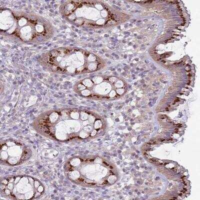 Immunohistochemistry-Paraffin: AKAIN1 Antibody [NBP2-14679] -  Staining of human rectum shows strong cytoplasmic positivity in glandular cells.