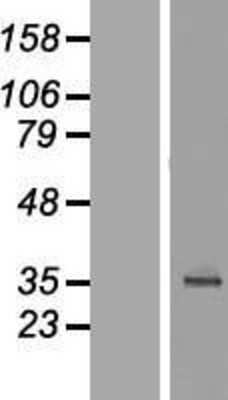 Western Blot: C18orf54 Overexpression Lysate (Adult Normal) [NBL1-08256] Left-Empty vector transfected control cell lysate (HEK293 cell lysate); Right -Over-expression Lysate for C18orf54.