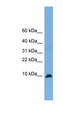 Western Blot: C18orf56 Antibody [NBP1-57050] - Human Brain lysate, concentration 0.2-1 ug/ml.