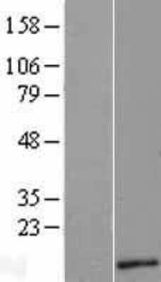 Western Blot: C18orf56 Overexpression Lysate (Adult Normal) [NBL1-08258] Left-Empty vector transfected control cell lysate (HEK293 cell lysate); Right -Over-expression Lysate for C18orf56.