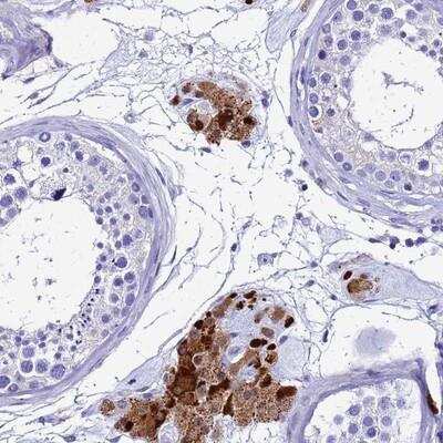 Immunohistochemistry: C18orf62 Antibody [NBP1-94149] - Staining of human testis shows strong cytoplasmic and nuclear positivity in leydig cells.