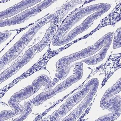 Immunohistochemistry-Paraffin: C18orf62 Antibody [NBP1-94149] - Staining of human endometrium shows low expression as expected.