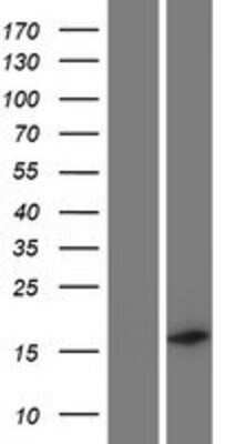 Western Blot: C19orf12 Overexpression Lysate (Adult Normal) [NBP2-08592] Left-Empty vector transfected control cell lysate (HEK293 cell lysate); Right -Over-expression Lysate for C19orf12.