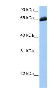 Western Blot: C19orf21 Antibody [NBP1-56743] - HepG2 cell lysate, concentration 0.2-1 ug/ml.