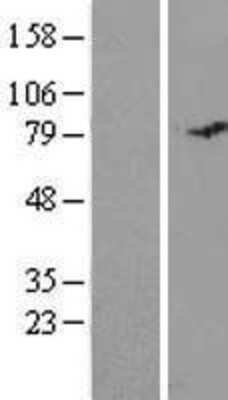Western Blot: C19orf21 Overexpression Lysate (Adult Normal) [NBL1-08263] Left-Empty vector transfected control cell lysate (HEK293 cell lysate); Right -Over-expression Lysate for C19orf21.