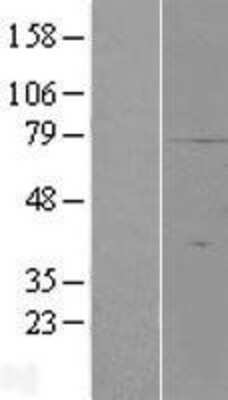 Western Blot: C19orf42 Overexpression Lysate (Adult Normal) [NBP2-06345] Left-Empty vector transfected control cell lysate (HEK293 cell lysate); Right -Over-expression Lysate for C19orf42.