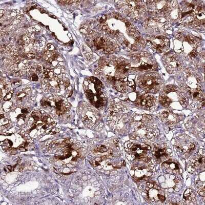Immunohistochemistry-Paraffin C19orf47 Antibody - BSA Free