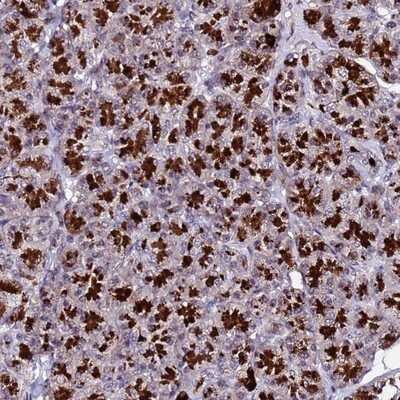 Immunohistochemistry-Paraffin: C19orf47 Antibody [NBP1-91723] - Staining of human pancreas shows strong granular cytoplasmic positivity in exocrine glandular cells.