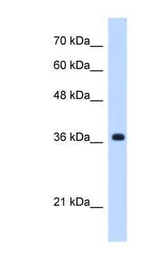 Western Blot: C19orf47 Antibody [NBP1-70445] - Jurkat cell lysate, concentration 0.2-1 ug/ml.