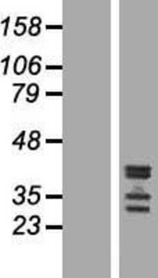 Western Blot: C19orf47 Overexpression Lysate (Adult Normal) [NBP2-04945] Left-Empty vector transfected control cell lysate (HEK293 cell lysate); Right -Over-expression Lysate for C19orf47.