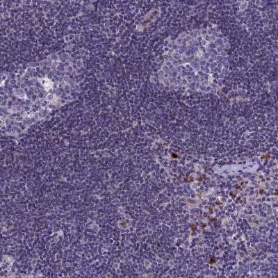 Immunohistochemistry-Paraffin: C19orf48 Antibody [NBP1-81210] - Staining of human lymph node shows strong cytoplasmic positivity in a small subset of lymphoid cells.
