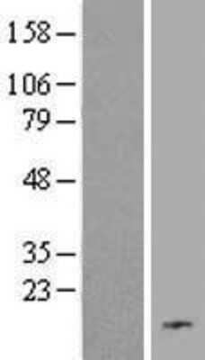 Western Blot: C19orf48 Overexpression Lysate (Adult Normal) [NBL1-08273] Left-Empty vector transfected control cell lysate (HEK293 cell lysate); Right -Over-expression Lysate for C19orf48.