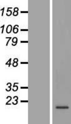 Western Blot: C19orf48 Overexpression Lysate (Adult Normal) [NBL1-08274] Left-Empty vector transfected control cell lysate (HEK293 cell lysate); Right -Over-expression Lysate for C19orf48.