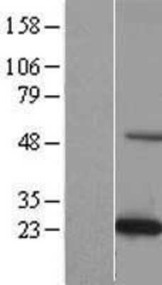 Western Blot: C19orf50 Overexpression Lysate (Adult Normal) [NBL1-08275] Left-Empty vector transfected control cell lysate (HEK293 cell lysate); Right -Over-expression Lysate for C19orf50.