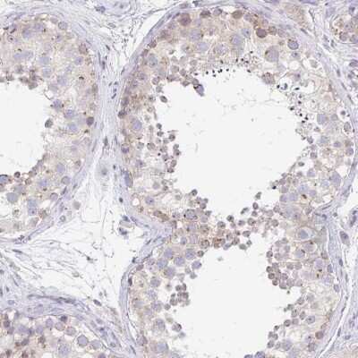 Immunohistochemistry-Paraffin: C19orf55 Antibody [NBP2-30902] - Staining of human testis shows moderate cytoplasmic positivity in cells in seminiferous ducts.