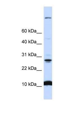 Western Blot: C19orf56 Antibody [NBP1-59969] - 721_B cell lysate, concentration 0.2-1 ug/ml.