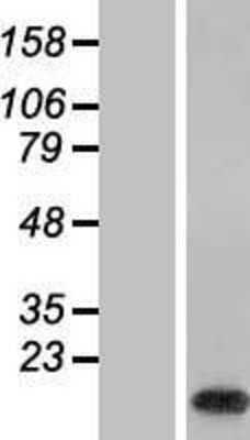 Western Blot: C19orf56 Overexpression Lysate (Adult Normal) [NBL1-08279] Left-Empty vector transfected control cell lysate (HEK293 cell lysate); Right -Over-expression Lysate for C19orf56.