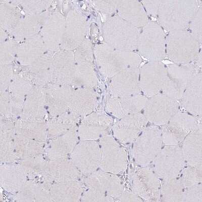 Immunohistochemistry-Paraffin: C19orf57 Antibody [NBP1-93524] - Staining of human skeletal muscle shows low expression as expected.