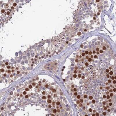 Immunohistochemistry-Paraffin: C19orf57 Antibody [NBP1-93524] - Staining of human testis shows high expression.