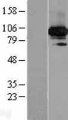 Western Blot: C19orf57 Overexpression Lysate (Adult Normal) [NBP2-06337] Left-Empty vector transfected control cell lysate (HEK293 cell lysate); Right -Over-expression Lysate for C19orf57.
