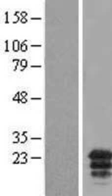 Western Blot MCEMP1 Overexpression Lysate