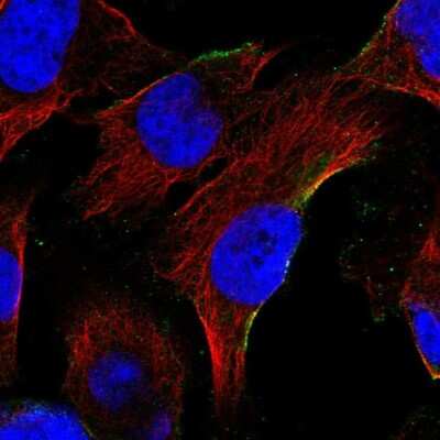 Immunocytochemistry/Immunofluorescence: C19orf60 Antibody [NBP1-93964] - Staining of human cell line U-251 MG shows positivity in plasma membrane.