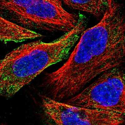 Immunocytochemistry/Immunofluorescence: C19orf60 Antibody [NBP1-93964] - Immunofluorescent staining of human cell line U-2 OS shows localization to vesicles.