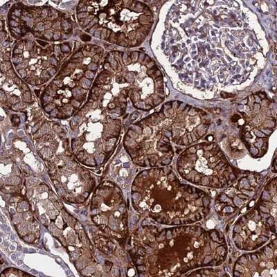 Immunohistochemistry-Paraffin: C19orf60 Antibody [NBP1-93964] - Staining of human kidney shows strong cytoplasmic and membranous positivity in cells in tubules.