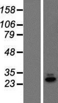 Western Blot: C19orf60 Overexpression Lysate (Adult Normal) [NBP2-08253] Left-Empty vector transfected control cell lysate (HEK293 cell lysate); Right -Over-expression Lysate for C19orf60.