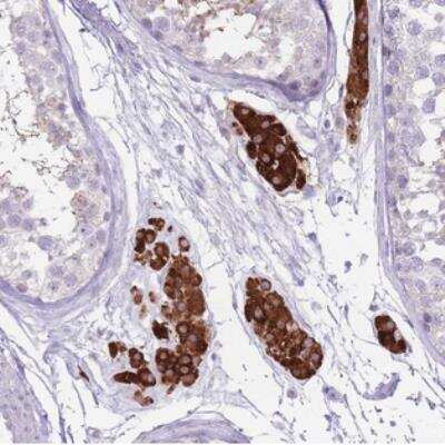 Immunohistochemistry: C19orf69 Antibody [NBP2-30800] - Staining of human testis shows strong cytoplasmic positivity in Leydig cells.