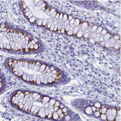 Immunohistochemistry: C19orf69 Antibody [NBP2-30986] - Staining of human rectum shows strong granular cytoplasmic positivity in glandular cells.