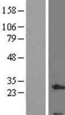 Western Blot: C19orf70 Overexpression Lysate (Adult Normal) [NBL1-14028] Left-Empty vector transfected control cell lysate (HEK293 cell lysate); Right -Over-expression Lysate for C19orf70.