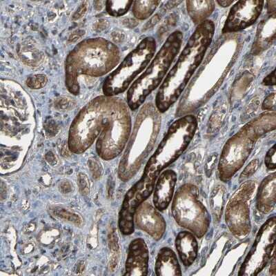 Immunohistochemistry-Paraffin: C1GALT1 Antibody [NBP1-88476] - Staining of human kidney shows moderate to strong cytoplasmic positivity in cells in tubules.