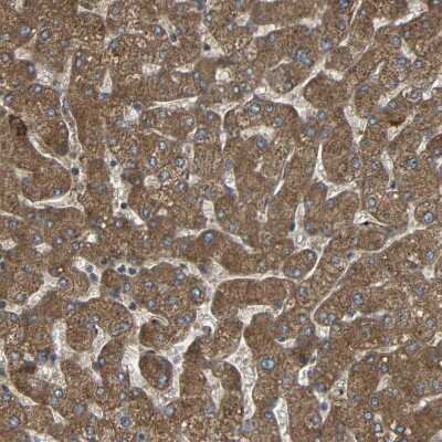 Immunohistochemistry-Paraffin: C1GALT1 Antibody [NBP1-88476] - Staining of human liver shows moderate cytoplasmic positivity in hepatocytes.