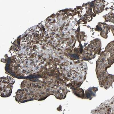 Immunohistochemistry-Paraffin: C1GALT1 Antibody [NBP1-88476] - Staining of human placenta shows moderate cytoplasmic positivity in trophoblastic cells.