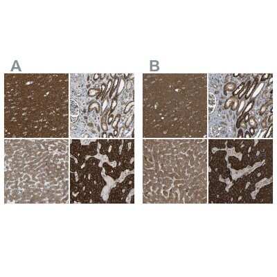 Immunohistochemistry-Paraffin: C1GALT1 Antibody [NBP1-88477] - Staining of human cerebral cortex, kidney, liver and parathyroid gland using Anti-C1GALT1 antibody NBP1-88477 (A) shows similar protein distribution across tissues to independent antibody NBP1-88476 (B).