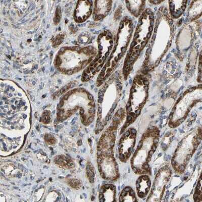 Immunohistochemistry-Paraffin: C1GALT1 Antibody [NBP1-88477] - Staining of human kidney shows moderate to strong cytoplasmic positivity in cells in tubules.