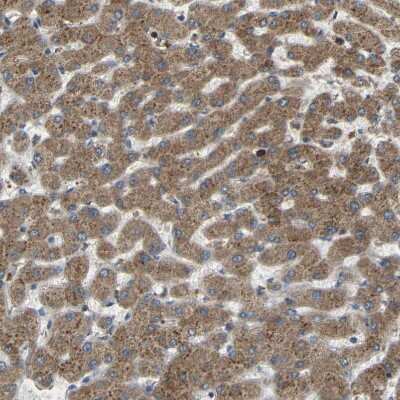 Immunohistochemistry-Paraffin: C1GALT1 Antibody [NBP1-88477] - Staining of human liver shows moderate cytoplasmic positivity in hepatocytes.