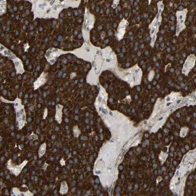 Immunohistochemistry-Paraffin: C1GALT1 Antibody [NBP1-88477] - Staining of human parathyroid gland shows strong cytoplasmic positivity in glandular cells.