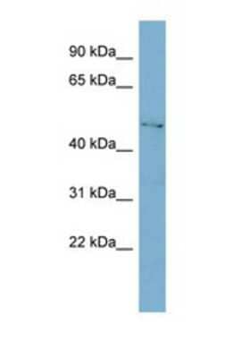 Western Blot: C1GALT1 Antibody [NBP1-69602] - This Anti-C1GALT1 antibody was used in Western Blot of HT1080     tissue lysate at a concentration of 1ug/ml.