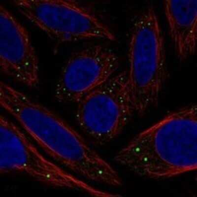 Immunocytochemistry/Immunofluorescence: C1GALT1C1 Antibody [NBP3-17811] - Staining of human cell line SiHa shows localization to vesicles.