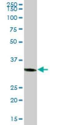 Western Blot: C1GALT1C1 Antibody [H00029071-B01P] - C1GALT1C1 MaxPab polyclonal antibody. Western Blot analysis of C1GALT1C1 expression in human liver.