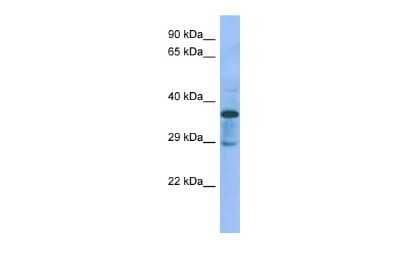 Western Blot: C1GALT1C1 Antibody [NBP2-84545] - Host: Rabbit. Target Name: C1galt1c1. Sample Type: Rat pancreas lysates. Antibody Dilution: 1.0ug/ml