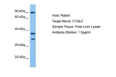 Western Blot: C1GALT1C1 Antibody [NBP2-84546] - Host: Rabbit. Target Name: C1GALT1C1. Sample Tissue: Human Fetal Liver. Antibody Dilution: 1.0ug/ml