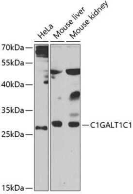 Western Blot: C1GALT1C1 Antibody [NBP2-92812] - Analysis of extracts of various cell lines, using C1GALT1C1 at 1:1000 dilution.Secondary antibody: HRP Goat Anti-Rabbit IgG (H+L) at 1:10000 dilution.Lysates/proteins: 25ug per lane.Blocking buffer: 3% nonfat dry milk in TBST.Detection: ECL Basic Kit .Exposure time: 90s.