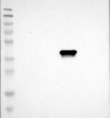 Western Blot: C1GALT1C1 Antibody [NBP3-17811] - Lane 1: Marker [kDa] 230, 130, 95, 72, 56, 36, 28, 17, 11;   Lane 2: RT4;   Lane 3: U-251 MG;   Lane 4: Human Plasma;   Lane 5: Liver;   Lane 6: Tonsil