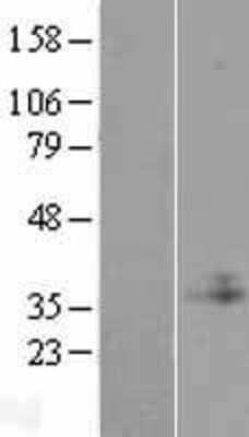 Western Blot: C1GALT1C1 Overexpression Lysate (Adult Normal) [NBL1-08286] Left-Empty vector transfected control cell lysate (HEK293 cell lysate); Right -Over-expression Lysate for C1GALT1C1.