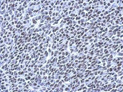 Immunohistochemistry-Paraffin: RSRP1 Antibody [NBP2-15641] - BT483 xenograft, using NPD014 antibody at 1:500 dilution. Antigen Retrieval: Trilogy™ (EDTA based, pH 8.0) buffer, 15min.