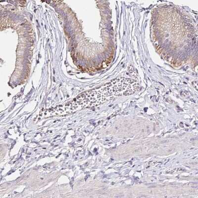 Immunohistochemistry-Paraffin: C1ORF63 Antibody [NBP2-32411] - Staining of human gallbladder shows cytoplasmic positivity in glandular cells.