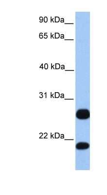 Western Blot: C1ORF63 Antibody [NBP1-70455] - HepG2 cell lysate, concentration 0.2-1 ug/ml.